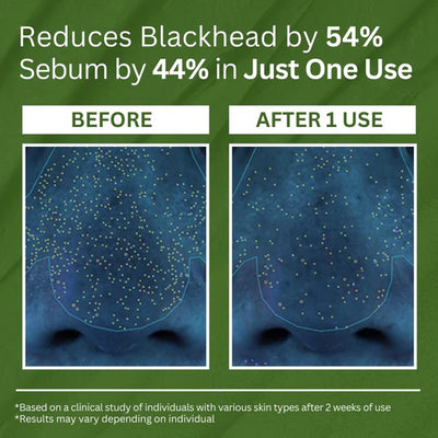 Holy Basil Bubble Deep Mask | Designed To Cleanse Pore Pollutants