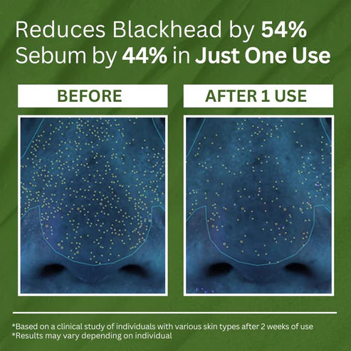 Holy Basil Bubble Deep Mask | Designed To Cleanse Pore Pollutants