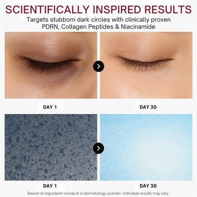 PDRN Regeneration Eye Patches (30 Pairs)