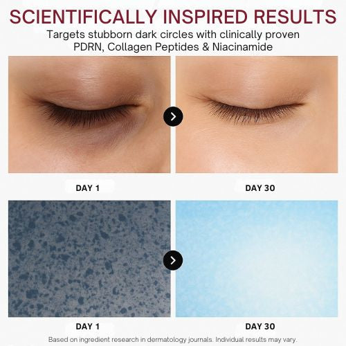 PDRN Regeneration Eye Patches (30 Pairs)